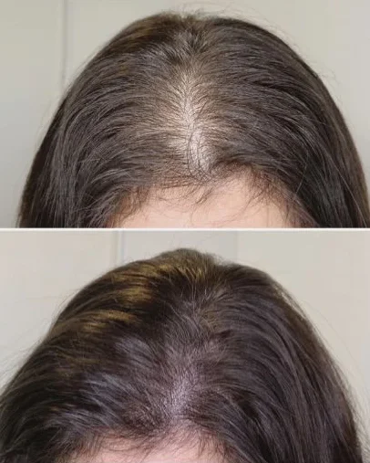 before-after-aoi-3